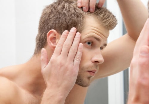 Hair Botox in London: A Comprehensive Guide for Men